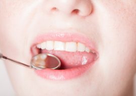 Can Cosmetic Dentistry Improve My Smile Aesthetics?