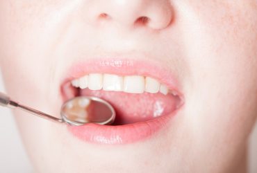 Can Cosmetic Dentistry Improve My Smile Aesthetics?