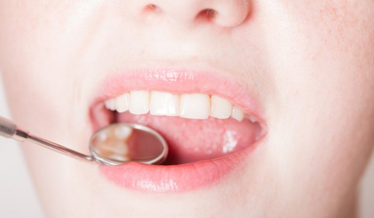 Can Cosmetic Dentistry Improve My Smile Aesthetics?